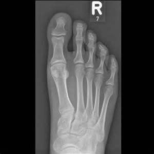 What Instagram filter did they use for this (not my foot, btw).